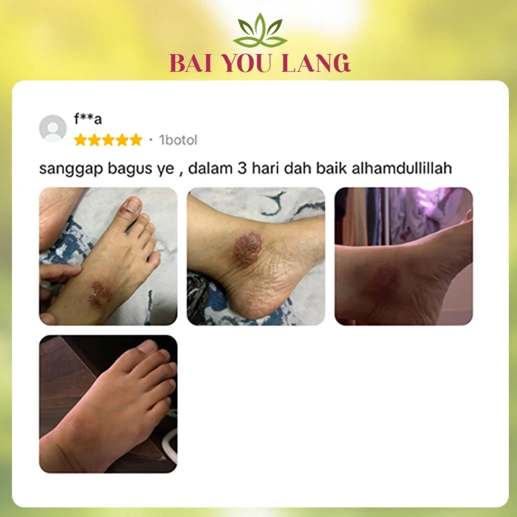EDIT-7.webp